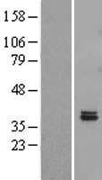 FAHD2B Human Over-expression Lysate