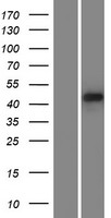 PDLIM7 Human Over-expression Lysate