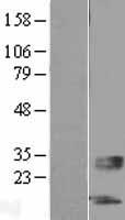 SERTM1 Human Over-expression Lysate