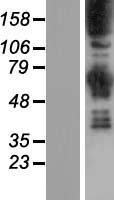 Synaptojanin (SYNJ1) Human Over-expression Lysate