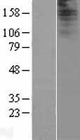 IQCF2 Human Over-expression Lysate