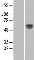 ENTPD2 Human Over-expression Lysate