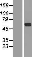 ZNF238 (ZBTB18) Human Over-expression Lysate