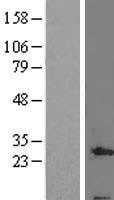 QIL1 (C19orf70) Human Over-expression Lysate
