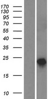 Reticulon 1 (RTN1) Human Over-expression Lysate