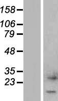 CTXN1 Human Over-expression Lysate