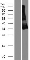TMIGD1 Human Over-expression Lysate