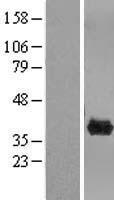 CLYBL Human Over-expression Lysate