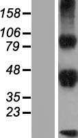DLK2 Human Over-expression Lysate