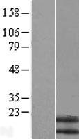 Neuromedin B (NMB) Human Over-expression Lysate