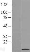 SFTA2 Human Over-expression Lysate