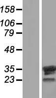 FAM9B Human Over-expression Lysate