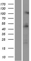 PRMT2 Human Over-expression Lysate