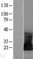 SNORC Human Over-expression Lysate