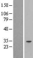 HAGHL Human Over-expression Lysate