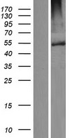 FBXW12 Human Over-expression Lysate