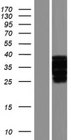 DUBA2 (OTUD6A) Human Over-expression Lysate