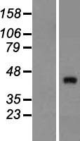 ZNF474 Human Over-expression Lysate
