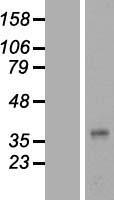 plasticity related gene 3 (PLPPR1) Human Over-expression Lysate