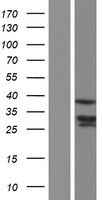 MBNL1 Human Over-expression Lysate