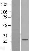 SAMD12 Human Over-expression Lysate