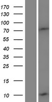DEFB132 Human Over-expression Lysate