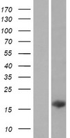 C14orf181 Human Over-expression Lysate
