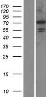 PADI6 Human Over-expression Lysate