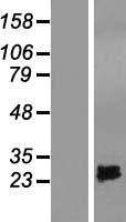 SPRYD4 Human Over-expression Lysate