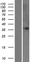 FAM43B Human Over-expression Lysate