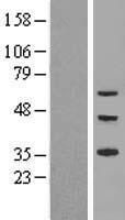 ZNF320 Human Over-expression Lysate