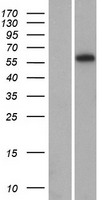 ARID5A Human Over-expression Lysate