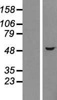 Choline kinase alpha (CHKA) Human Over-expression Lysate