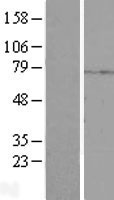 PRKACB Human Over-expression Lysate