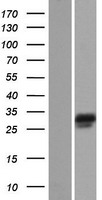 Nebulette (NEBL) Human Over-expression Lysate
