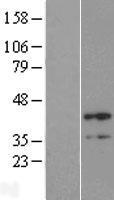 B4GALT4 Human Over-expression Lysate
