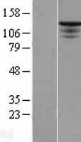 DENND2B Human Over-expression Lysate