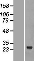 CCDC103 Human Over-expression Lysate