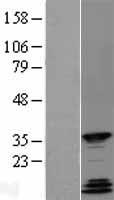 QK1 (QKI) Human Over-expression Lysate