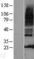 5HT3A receptor (HTR3A) Human Over-expression Lysate