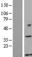 TTDA (GTF2H5) Human Over-expression Lysate