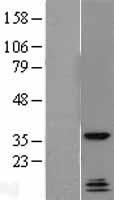 QK1 (QKI) Human Over-expression Lysate