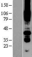 PORCN Human Over-expression Lysate