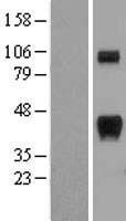 Calcipressin 1 (RCAN1) Human Over-expression Lysate