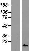 CCDC23 (SVBP) Human Over-expression Lysate