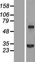 Transglutaminase 2 (TGM2) Human Over-expression Lysate