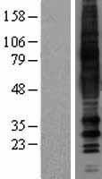GPCR TGR7 (MRGPRD) Human Over-expression Lysate