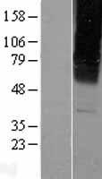 GABA A Receptor gamma 2 (GABRG2) Human Over-expression Lysate
