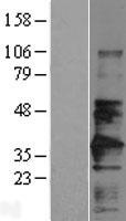 CD147 (BSG) Human Over-expression Lysate