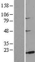 MSRB3 Human Over-expression Lysate